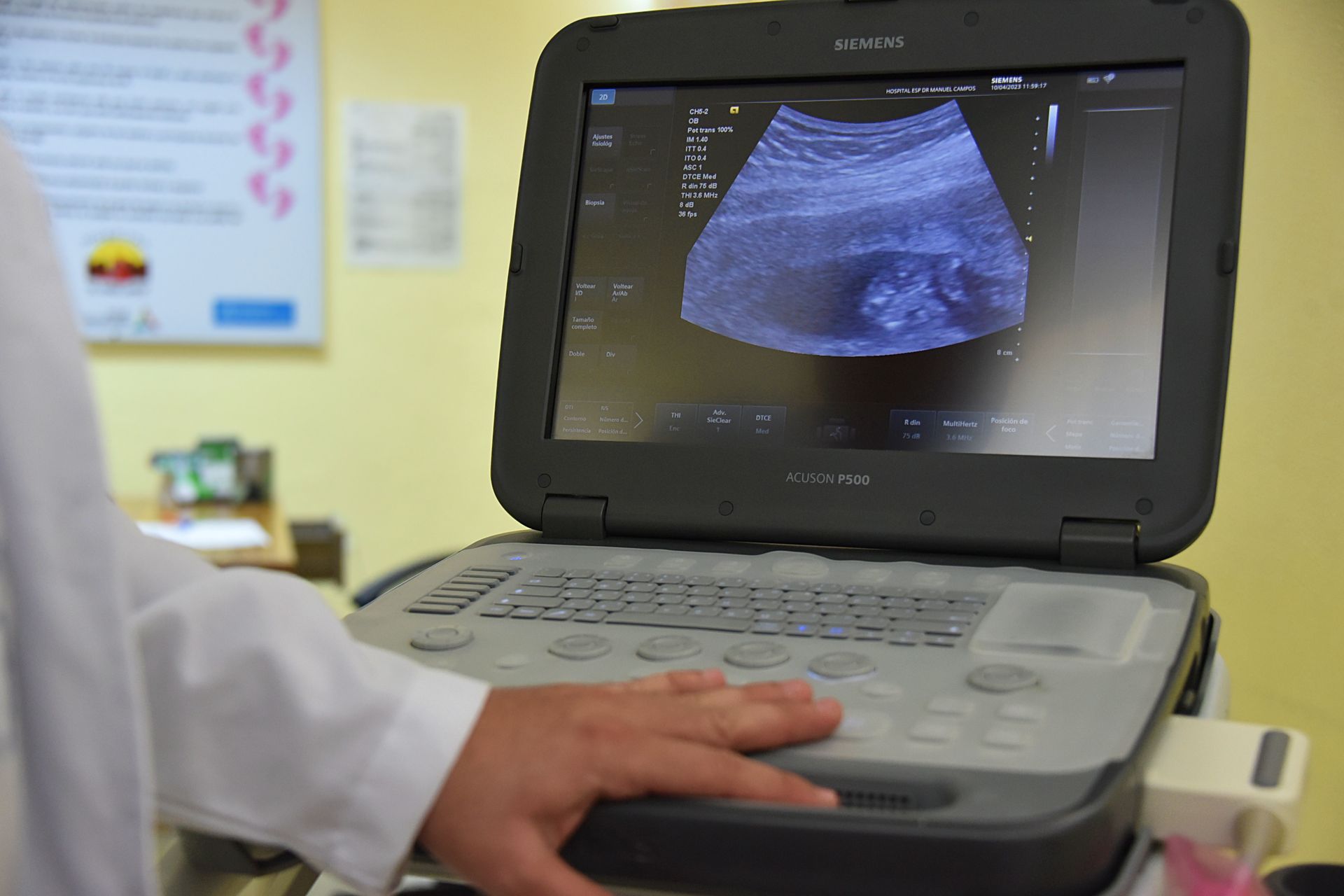Ecógrafo en una consulta de fisioterapia